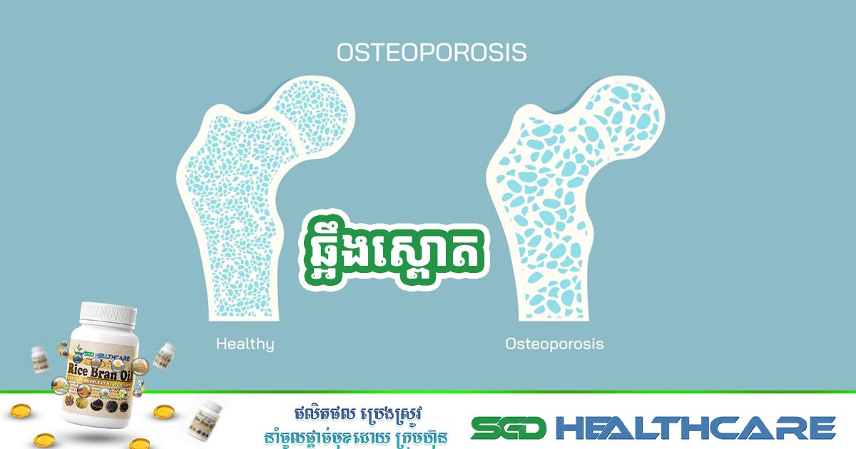 ឆ្អឹងស្ពោត- Osteopenia